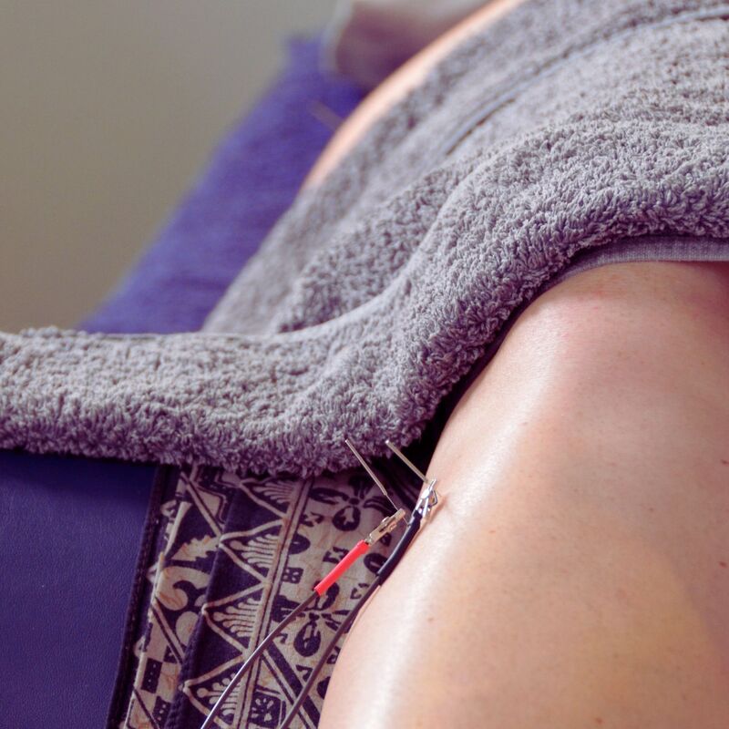 Electroacupuncture