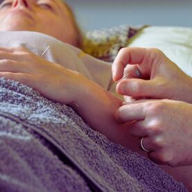 Acupuncture in Albany